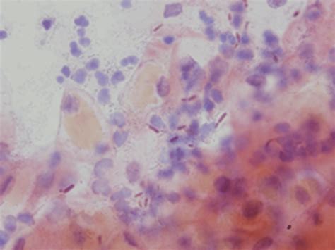 coccobacilli pap test|Pap smear .